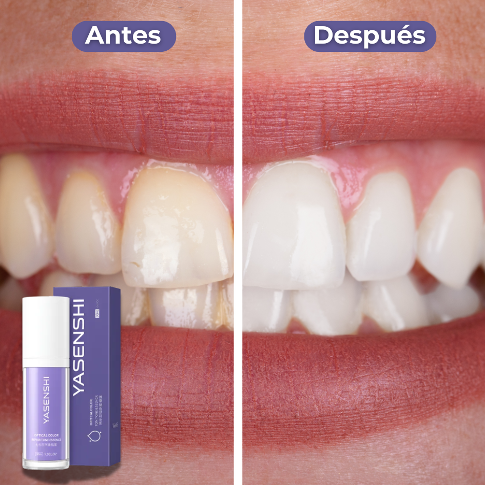 YASENSHI™ Blanqueador Dental 🦷 | 2x1 HOY