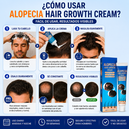 Alopecia Crema Para Crecimiento Capilar