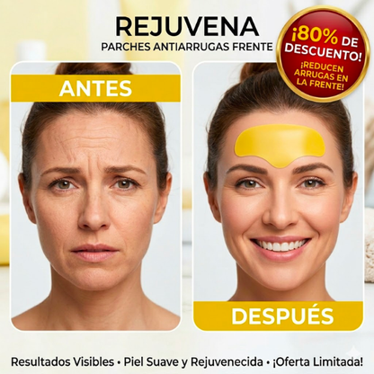 REJUVENA™ - Parches Antiarrugas🍊 | 🚨80% OFF SOLO HOY🚨