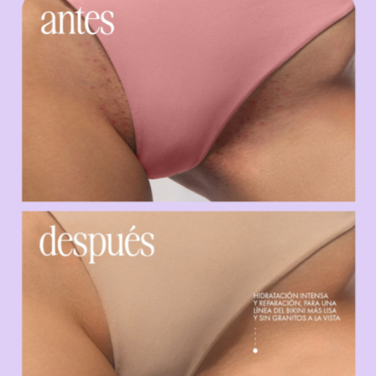 TRULY GLAZED™ Aclarador Intimo 💜